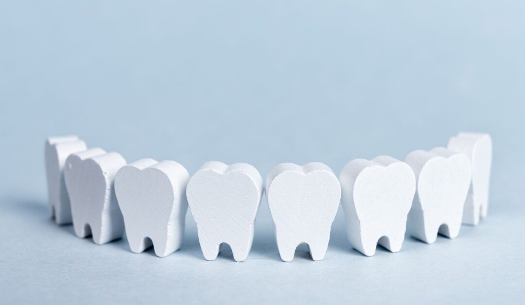 Les avantages des implants dentaires en Turquie : coûts, qualité et expertise