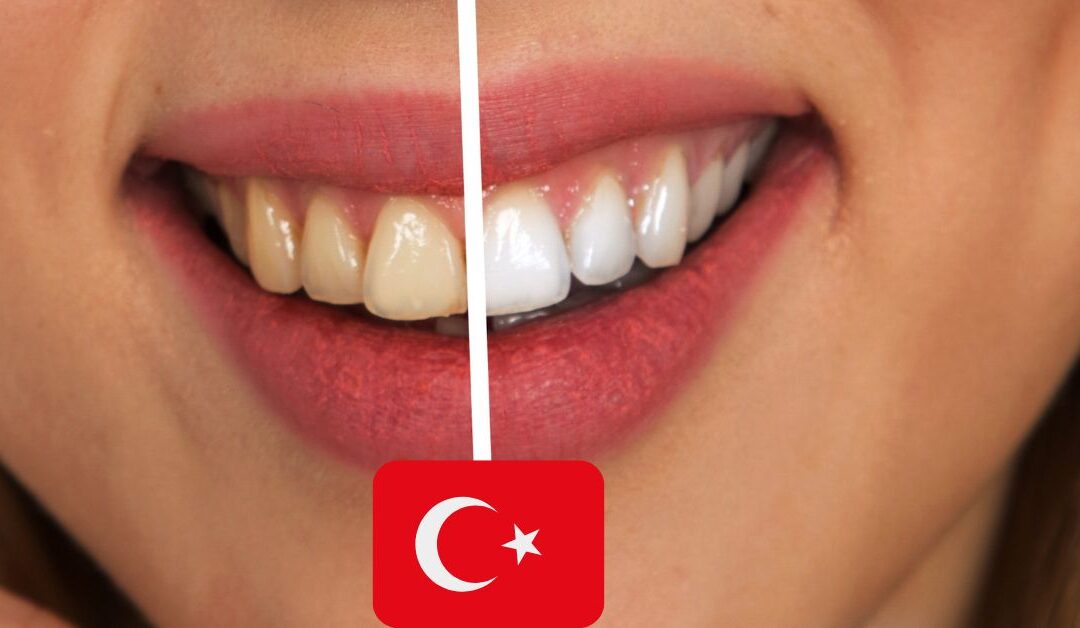 Turquie : les technologies disponibles pour vos soins dentaires